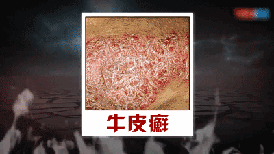 1755095476171662.gif